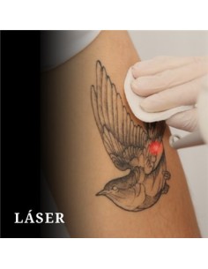 Taller de LASER - Micro y Tattoo