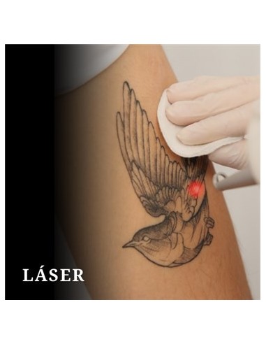 Taller de LASER - Micro y Tattoo