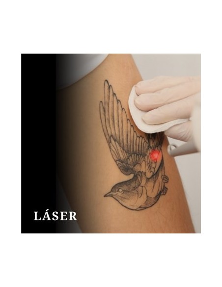Taller de LASER - Micro y Tattoo Taller de LASER - Micro y Tattoo